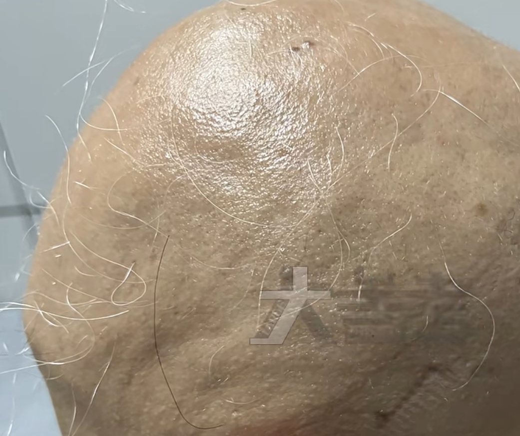 惨不忍睹！20岁女孩经历"恐怖一个月"！原因令网友唏嘘：代价太大