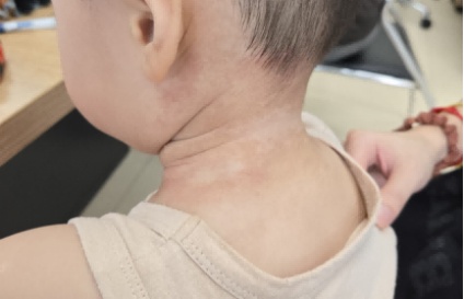 浙江一对母子相继患“怪病”，红斑爬满全身痒得无法睡觉！元凶是它，很多人家里在用…