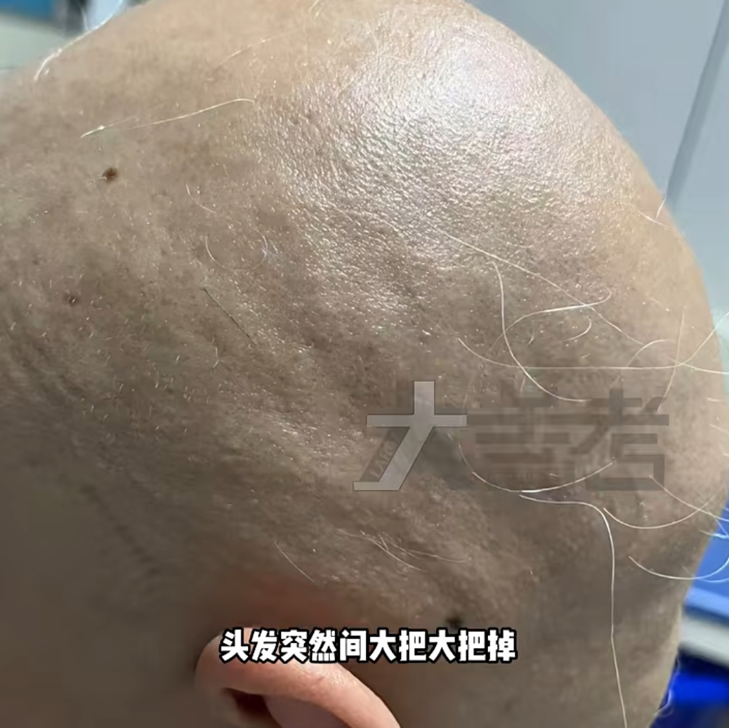 惨不忍睹！20岁女孩经历"恐怖一个月"！原因令网友唏嘘：代价太大