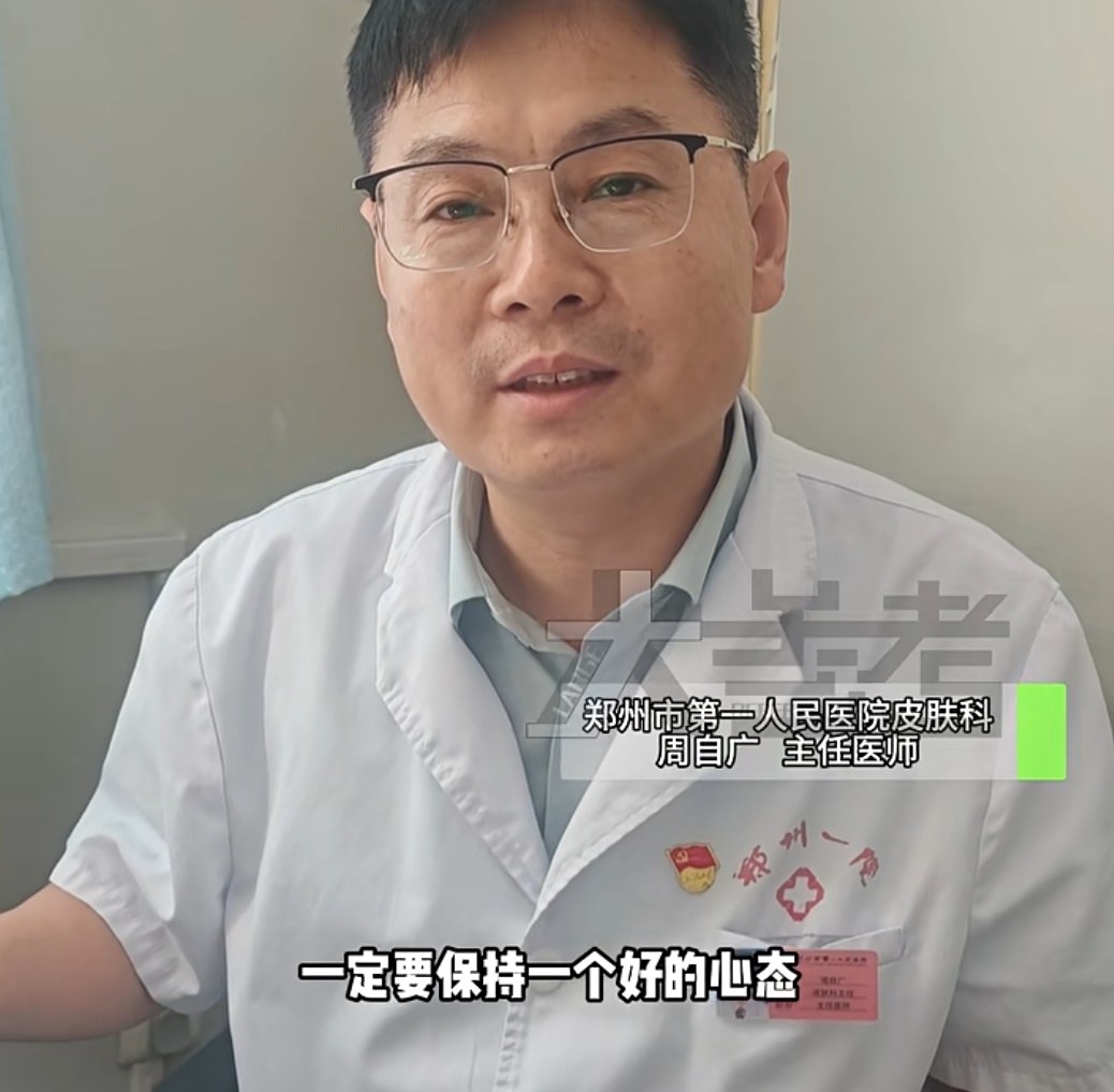 20岁女孩失恋一个月，毛发突然全部脱落！医生提醒→