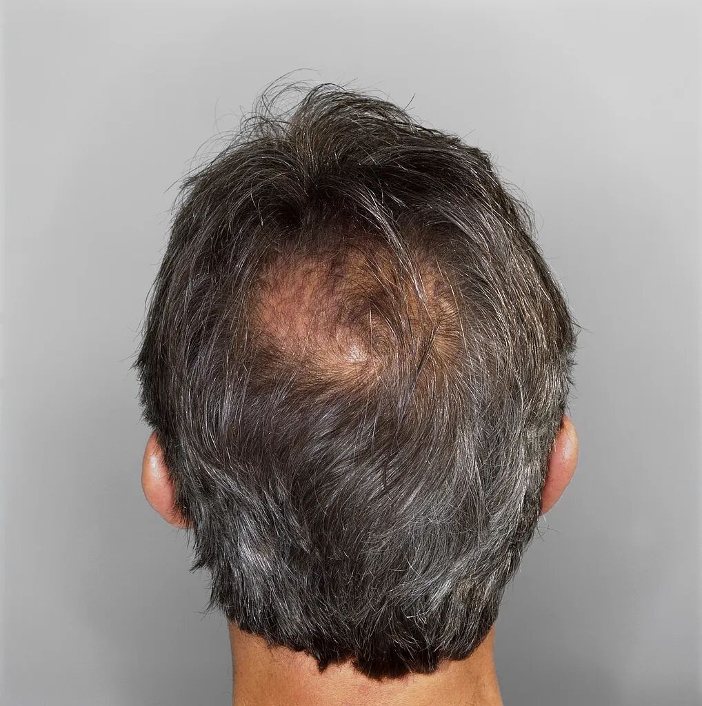 惨不忍睹！20岁女孩经历"恐怖一个月"！原因令网友唏嘘：代价太大