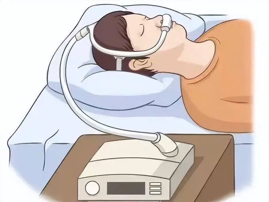 睡眠呼吸暂停:别把打鼾当小事 睡眠呼吸暂停:别把打鼾当小事