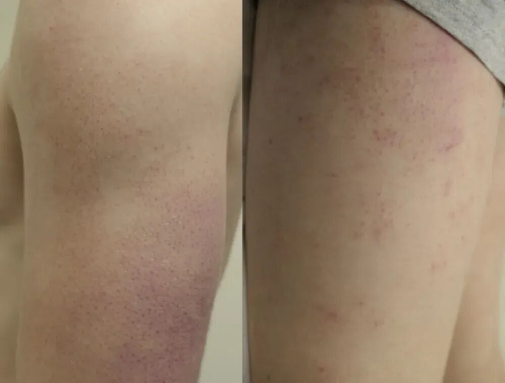 别抠了！这些小颗粒真不是痘痘，也别随便用药！