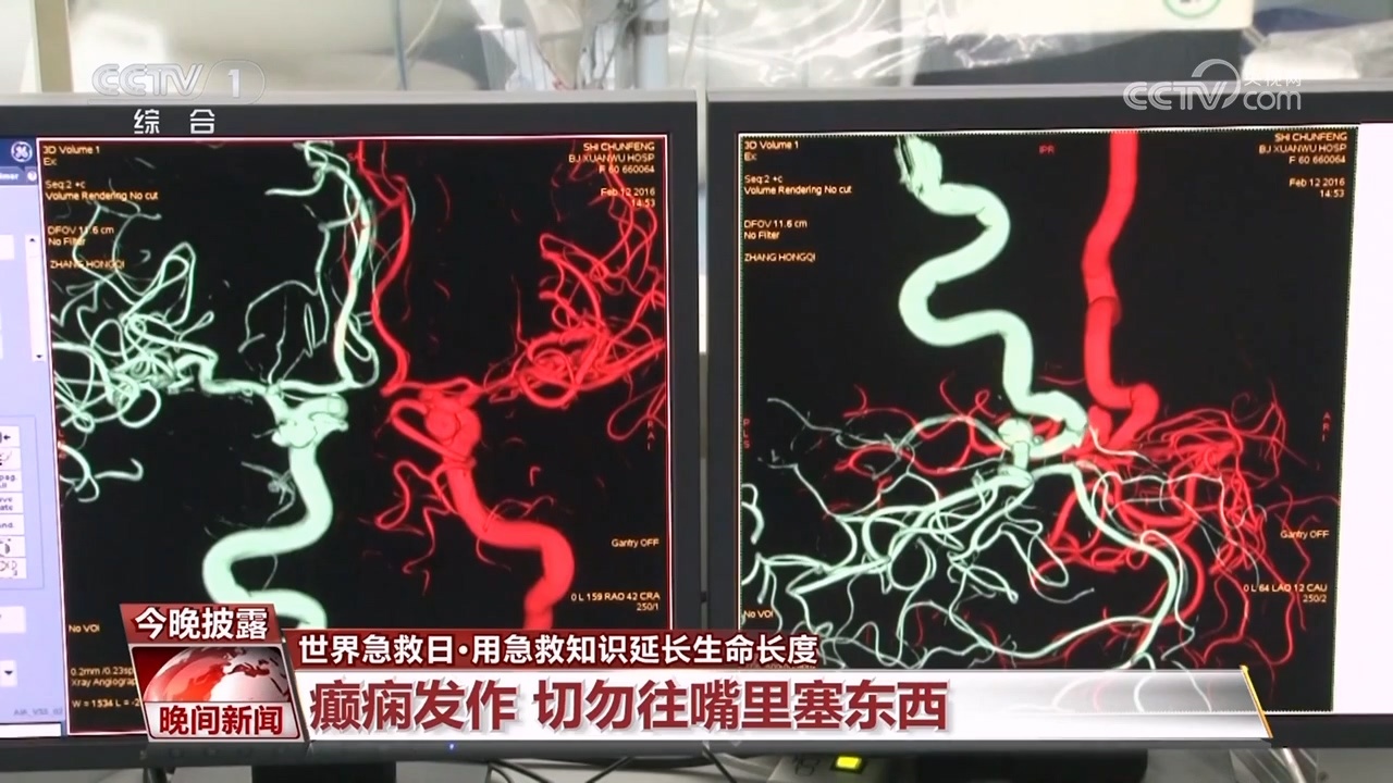 这些急救知识，关键时刻可延长生命长度