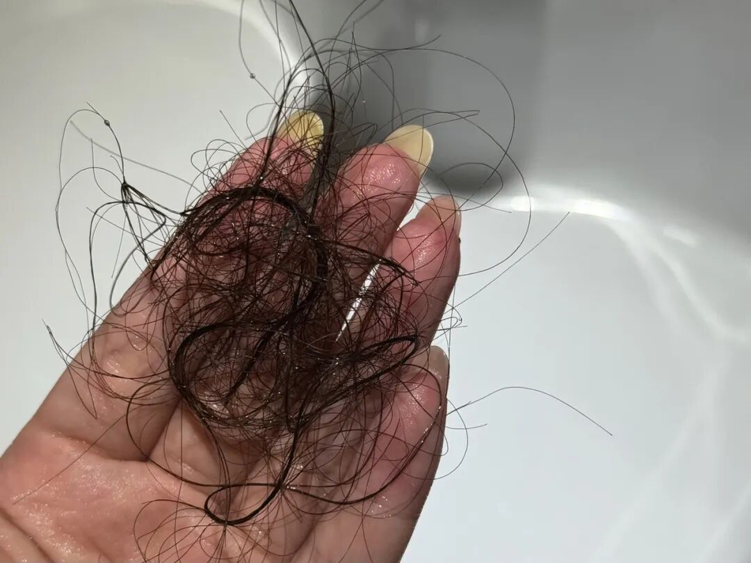 需求猛增！大量年轻人涌入门诊？！有人崩溃：我还不到30岁！医生提醒→