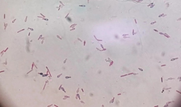 毒性约为砒霜的1000万倍!赶紧查查冰箱有没有 毒性约为砒霜的1000万倍!赶紧查查冰箱有没有