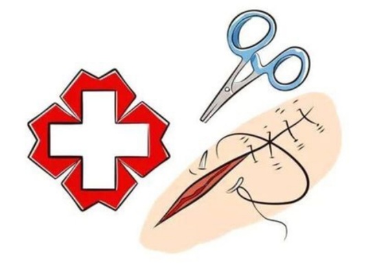 拆线后伤口就万事大吉了吗？疤痕护理不可忽视!