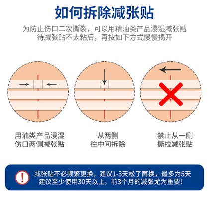 拆线后伤口就万事大吉了吗？疤痕护理不可忽视!