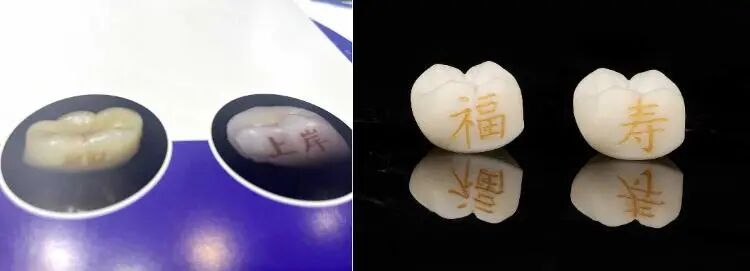 牙齿也能“文身”？口腔不是许愿池，医生提醒：不建议临床使用！