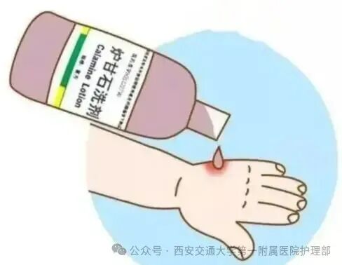 西安多区发现隐翅虫？千万别拍！毒液堪比硫酸