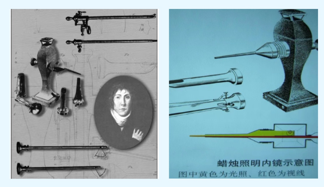 警惕！超8成人确诊已到晚期！！！医生紧急提醒：40岁后这项检查必须提上日程→