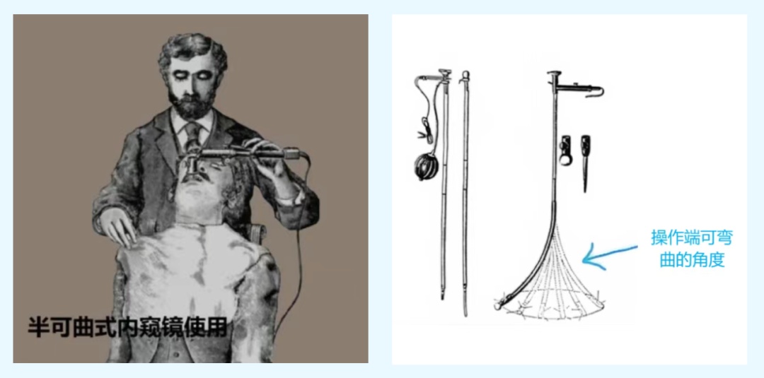 警惕！超8成人确诊已到晚期！！！医生紧急提醒：40岁后这项检查必须提上日程→