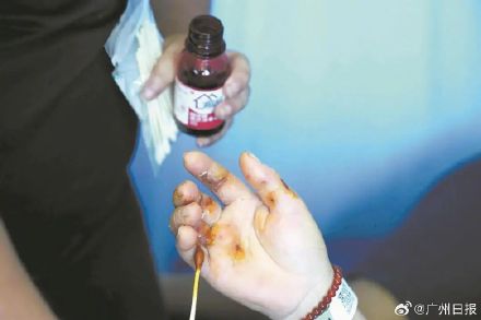 坠井被蛇缠身女子曾向小猫求救