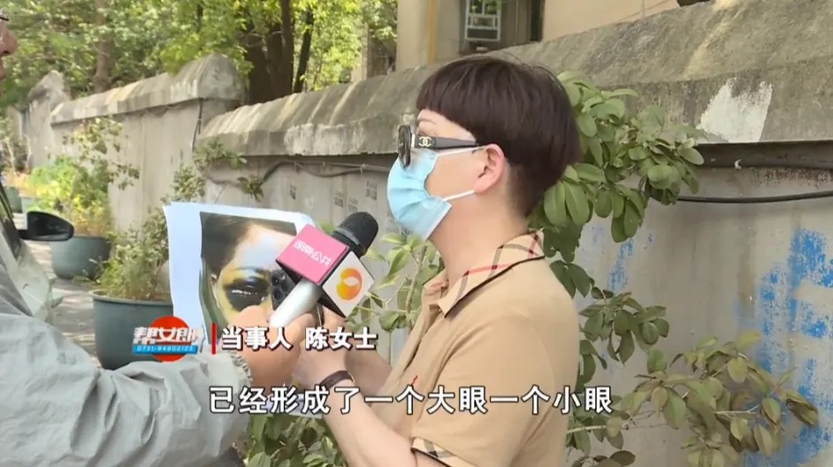 上海58岁女子整容后肿成“熊猫”！面部大片淤血，眼睛和嘴巴肿胀发紫！10天还未恢复