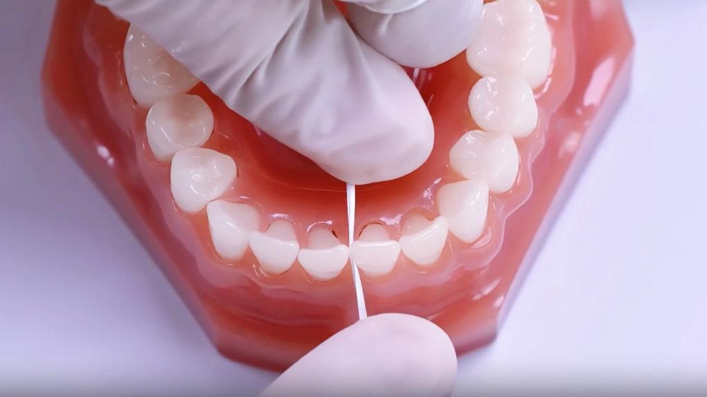 横刷？还是竖刷？你可能一直刷错牙！