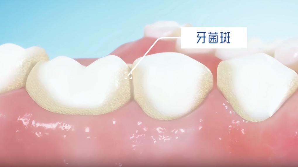 横刷？还是竖刷？你可能一直刷错牙！