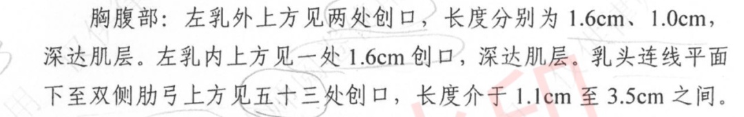 女子提离婚7天后遭杀害，丈夫因“抑郁发作”被判死缓