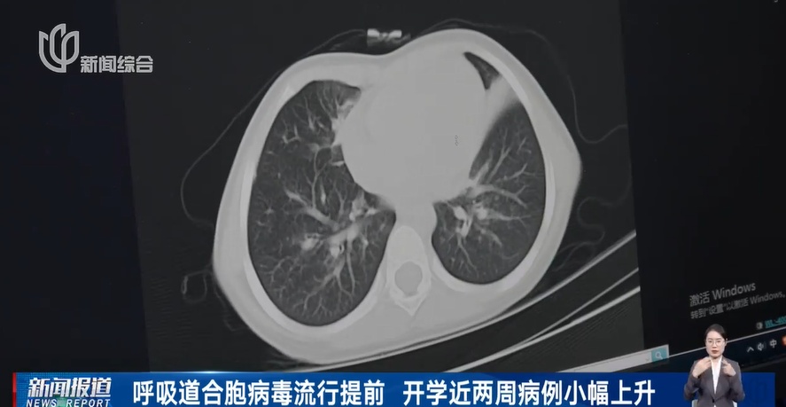 上海阳性确诊人数正在上升！今年感染季提前了！专家最新研判此类人群特别注意