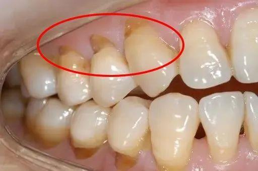 口腔健康关联全身 这份超实用牙齿清洁秘籍速存
