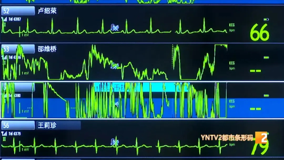云南省首例！患者在心脏不停跳的情况下植入人工心脏！