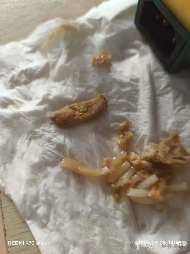 “让人恶心得想吐！”知名螺狮粉被曝吃出疑似脚趾甲、烟头等异物，网友：维权艰难