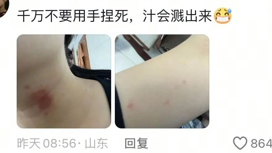 警惕“飞行的硫酸”！济南多人遭隐翅虫袭击