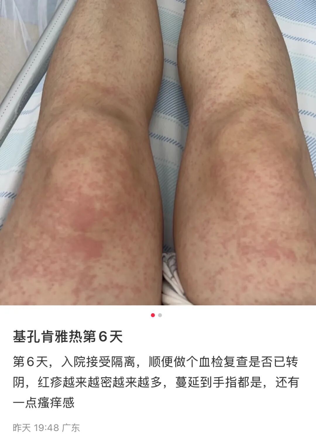 台风将至，疫情突然反弹！激增2238病例！此地启动突发公共卫生事件应急响应…
