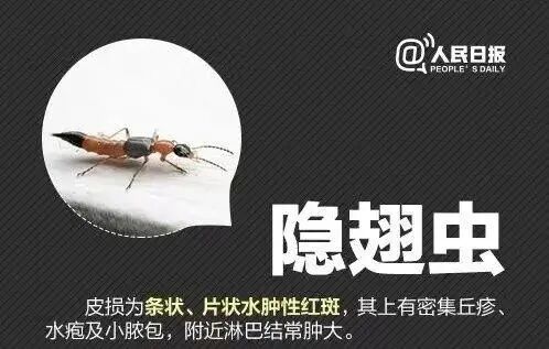 警惕“飞行的硫酸”！济南多人遭隐翅虫袭击
