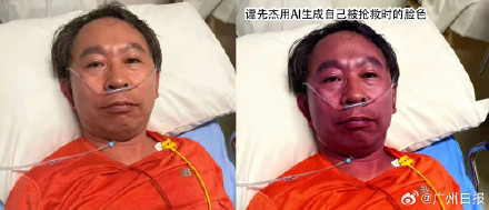 协和专家吃头孢过敏进抢救室