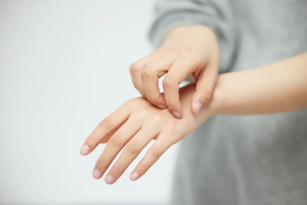 皮肤干燥、脱屑、瘙痒、皲裂……教您应对干燥性湿疹