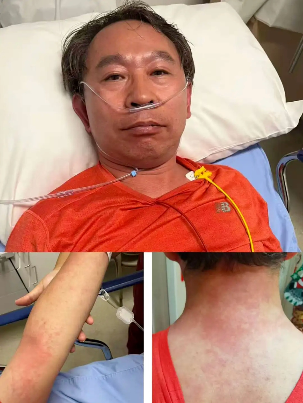 医生吃头孢遇险 以前不过敏的药物也不能掉以轻心！