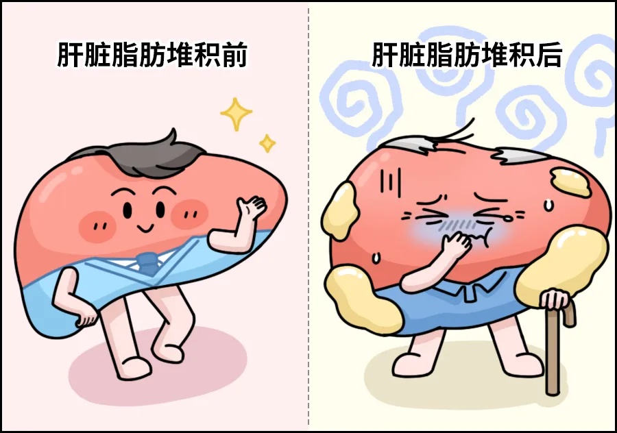 喝下去的糖VS吃下去的糖，哪个更伤身？