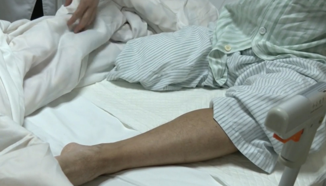 男子腿痛误当腰突,两周后脚趾变黑被迫截肢 男子腿痛误当腰突,两周后脚趾变黑被迫截肢