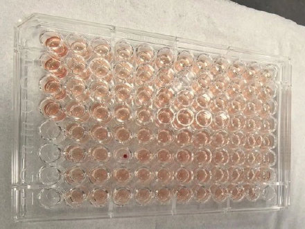 广东顺德发现首例钻石血，比“熊猫血”罕见百倍