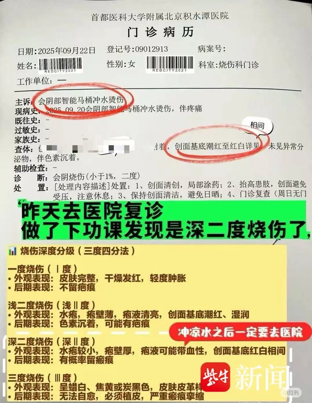 智能马桶突然喷开水，女子上厕所被烫伤