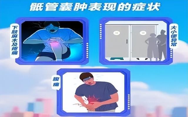 这种“囊肿”，或和足球一样大！有癌变风险！医生提醒→