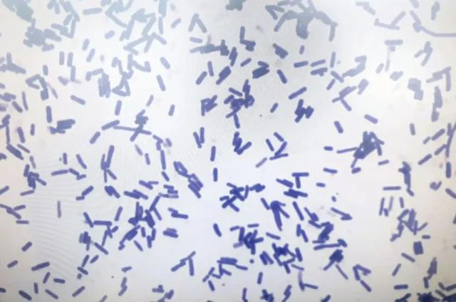 看似干净，但细菌超标的4种食物！吃错小心进医院