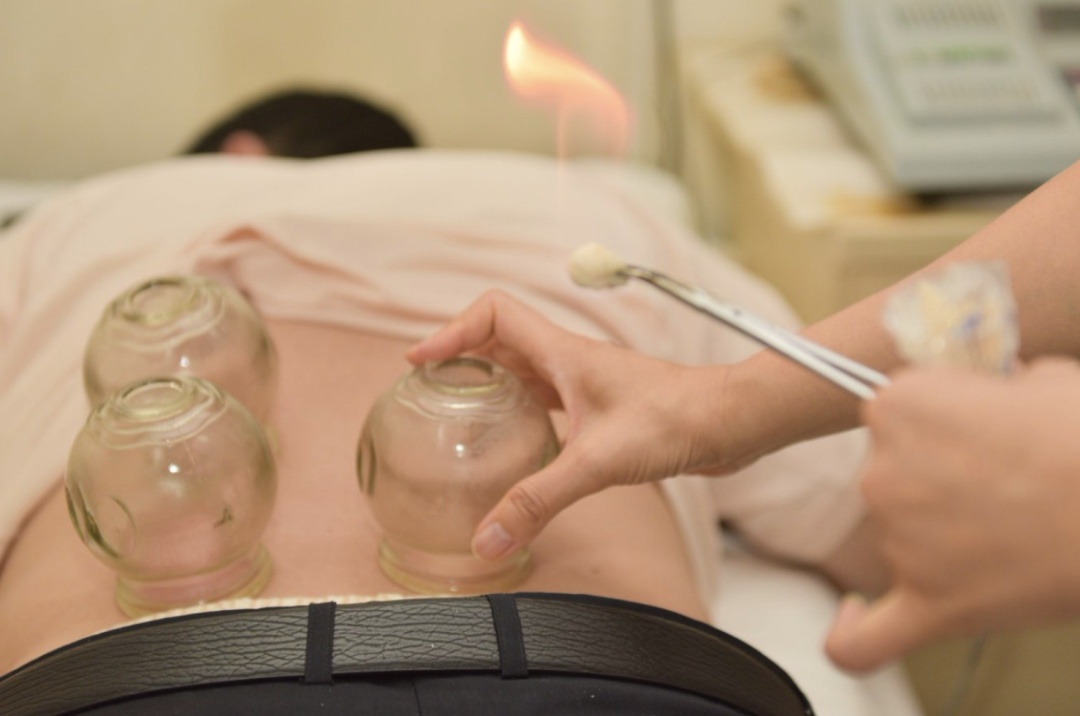 武汉一男子连拔2天火罐，突然高位截瘫！医生痛心提醒5个拔罐误区