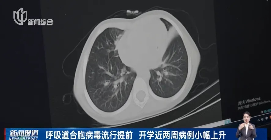 婴儿3天变重症,肺部症状集中爆发!这种病毒近期小心,再次提醒 婴儿3天变重症,肺部症状集中爆发!这种病毒近期小心,再次提醒