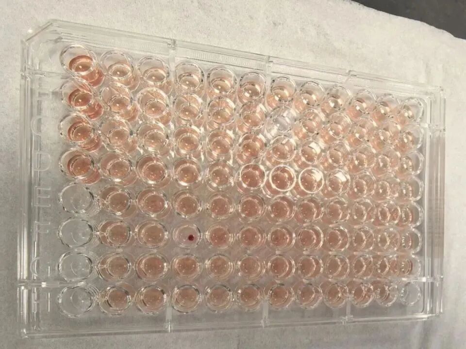 极度罕见！一例“钻石血”被发现