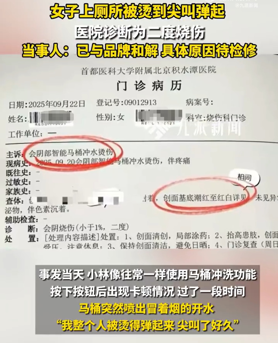 智能马桶喷出开水，女子上厕所被烫到尖叫弹起