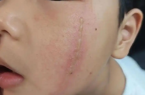 雨后大量出现！遇到这种虫，千万别拍！