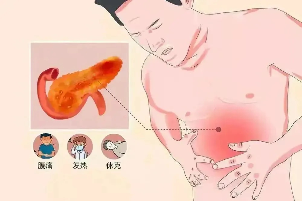 32岁男子体内抽出“牛奶血”，这样吃饭危害有多大？