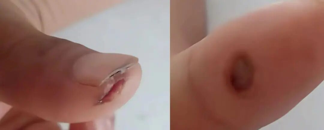一个油桶救了一条命！记住这5字诀，关键时刻能保命