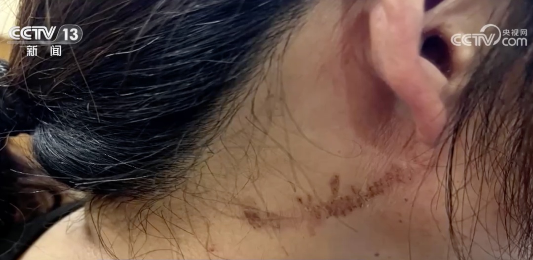 近期正活跃，遇到千万不要拍打！