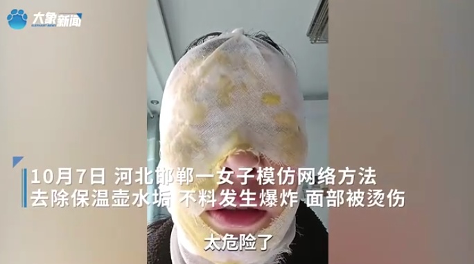 瞬间爆炸！女子模仿网络“妙招”：白糖加白醋烧开除水垢，脸被严重烫伤