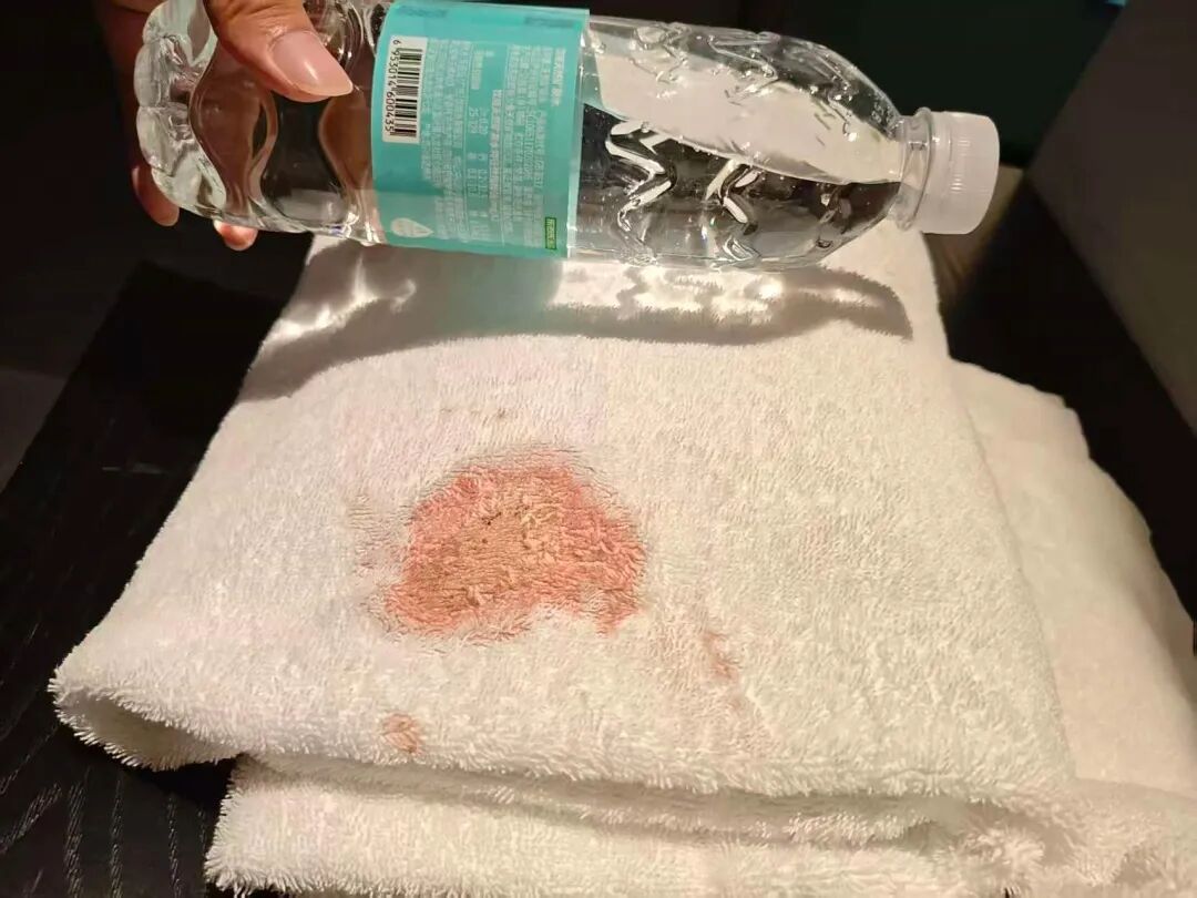 男子发现浴巾上有血迹，酒店回应！