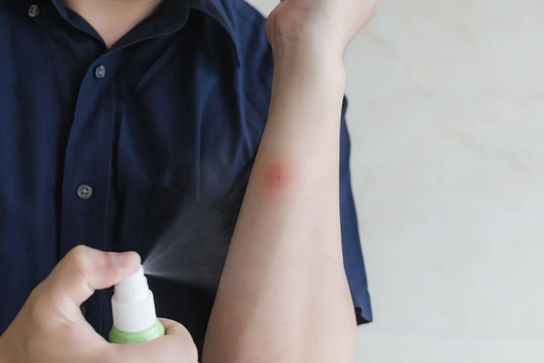 “半小时被咬12个包”！上海人崩溃！都10月了，蚊子怎么比夏天还多？如何防蚊、驱蚊？