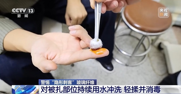 玻璃纤维扎进皮肤怎么办？别慌！正确处理步骤来了