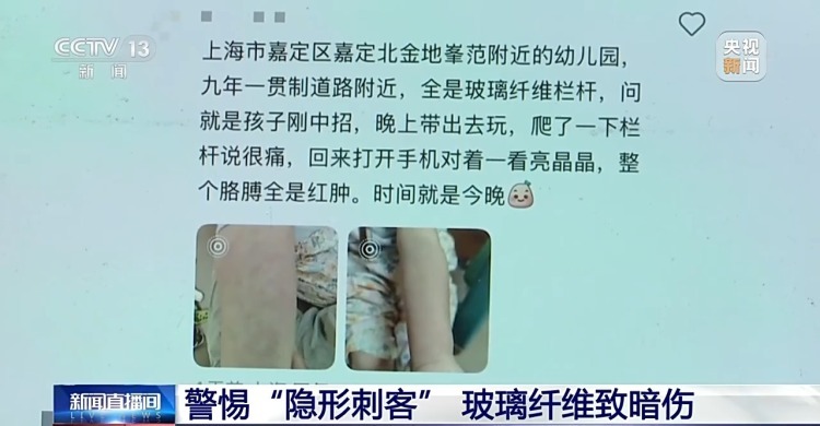 玻璃纤维扎进皮肤怎么办？别慌！正确处理步骤来了